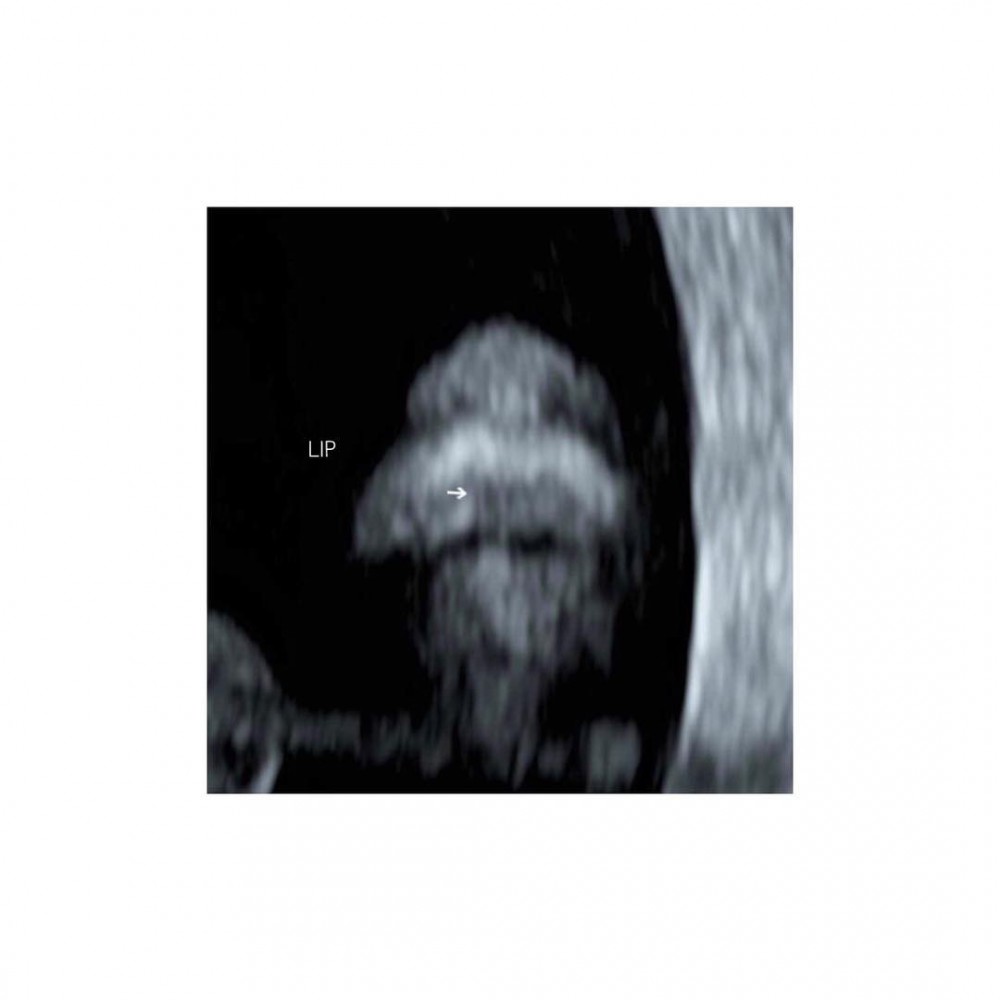 kikiting_official_28754133_228828384523260_3714383061559803904_n