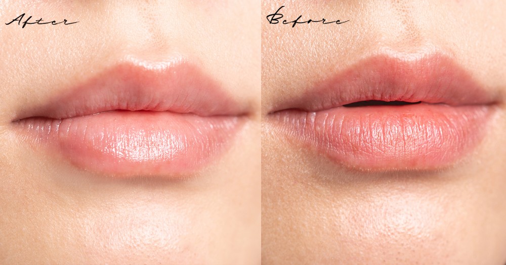 Blistex碧唇小藍罐經典保濕潤唇膏試用