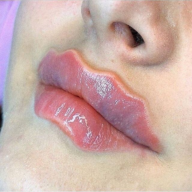 豐唇