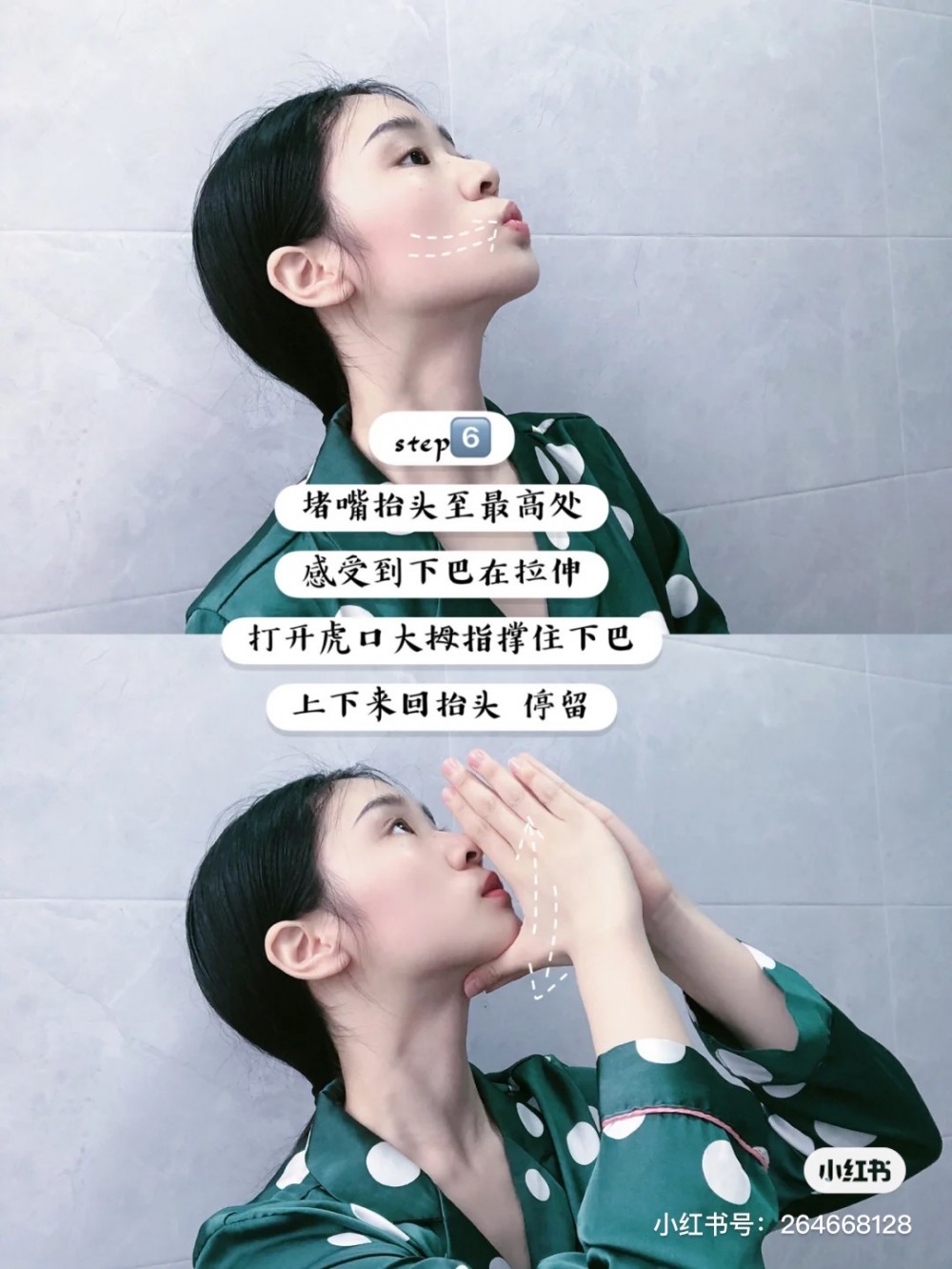 拉提下巴至頸部線條