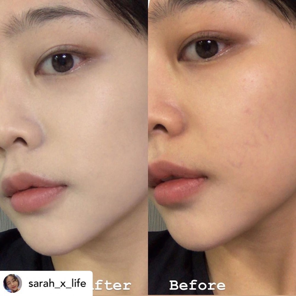 IG@ponyeffect_official 