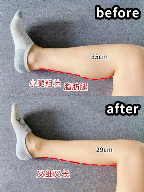 小紅書@Q敲敲敲敲敲可爱