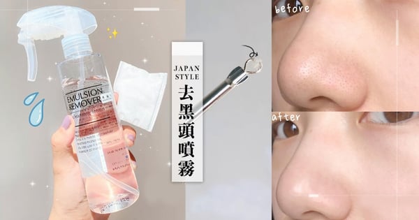 日本熱賣No.1去黑頭噴霧～一噴3效溶解油脂粉刺還可減少背部暗瘡！