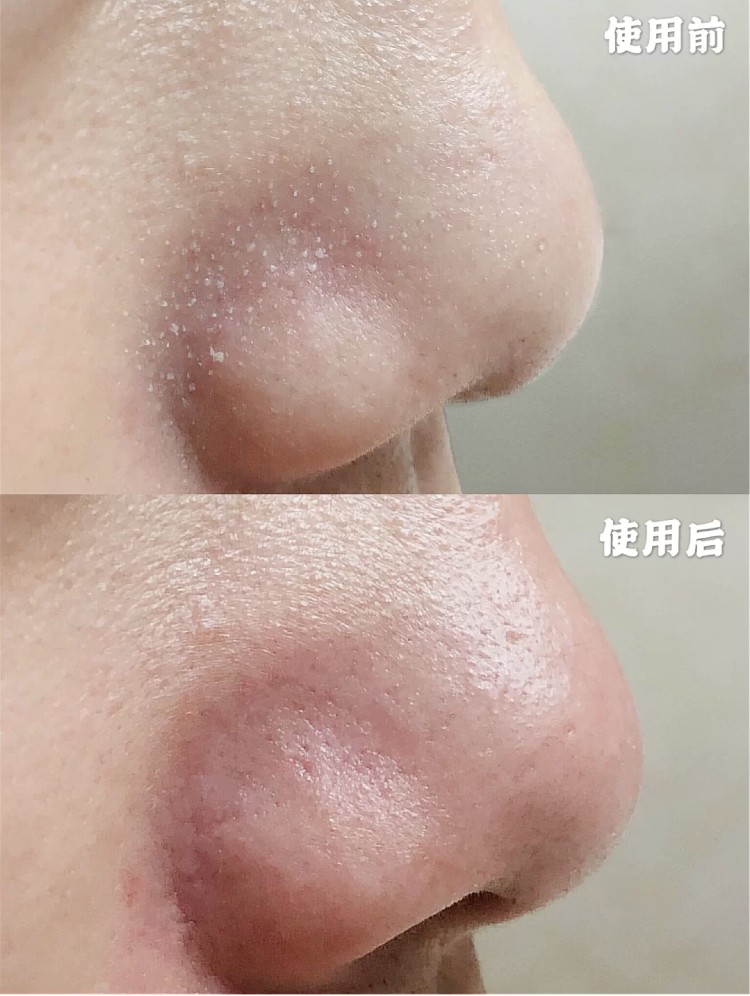 小紅書