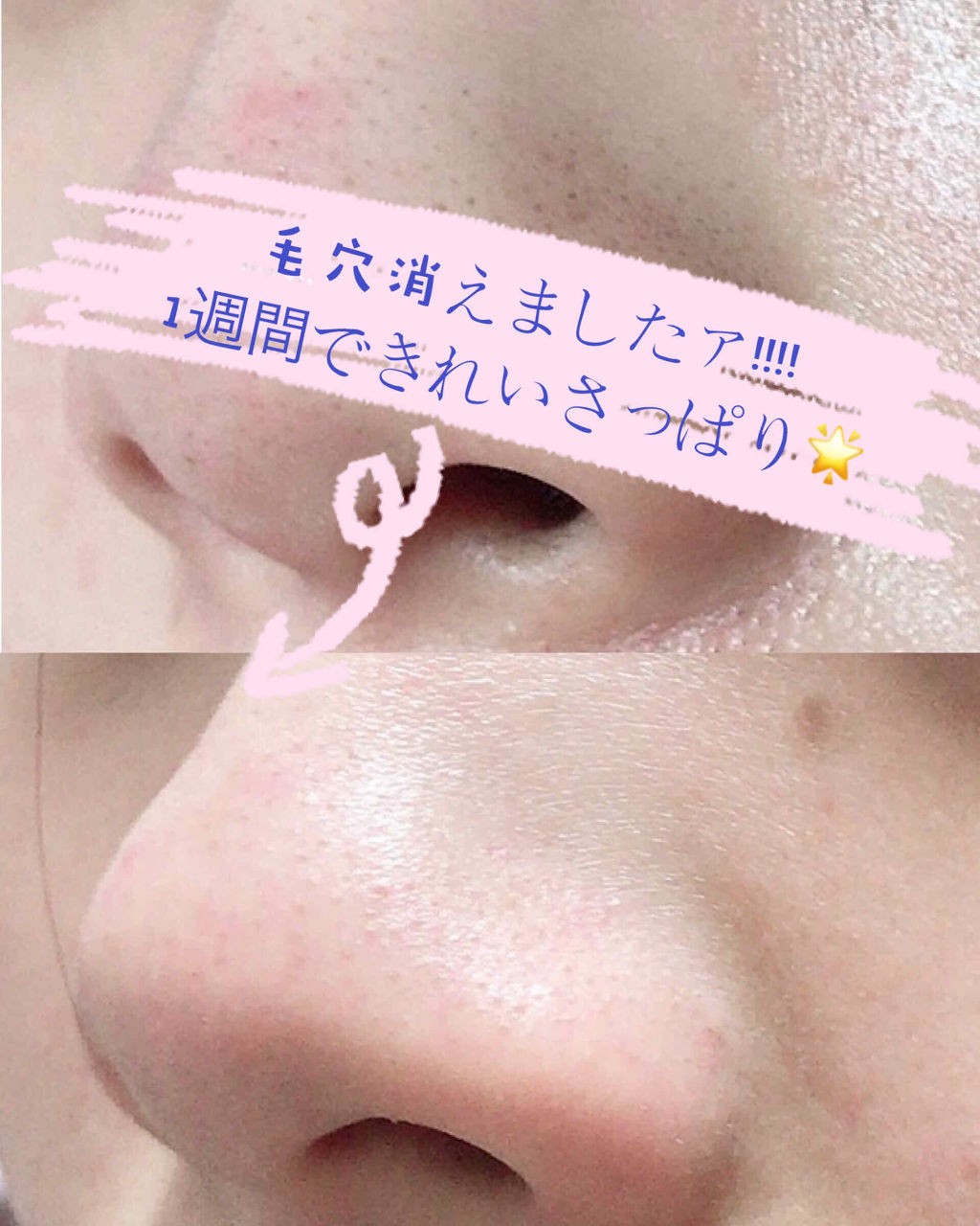 lipscosme