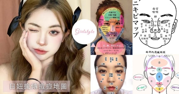 日妞IG瘋傳「痘痘地圖」～這裡長痘居然是因為吃太多？