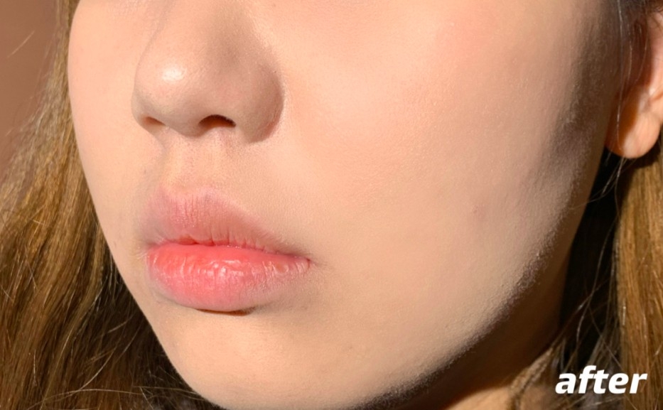 小紅書＠一碗粥