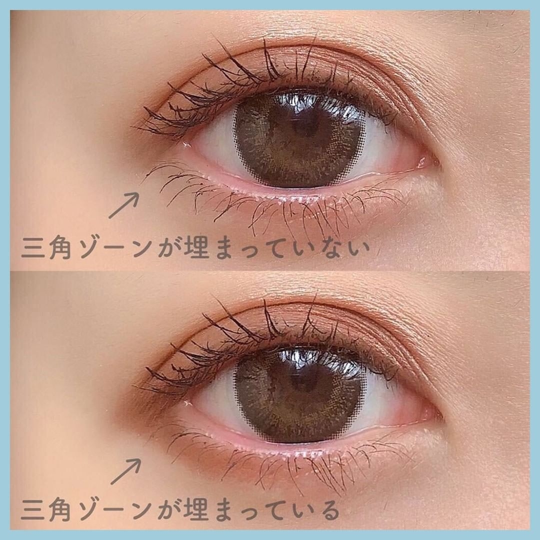 眼尾三角形