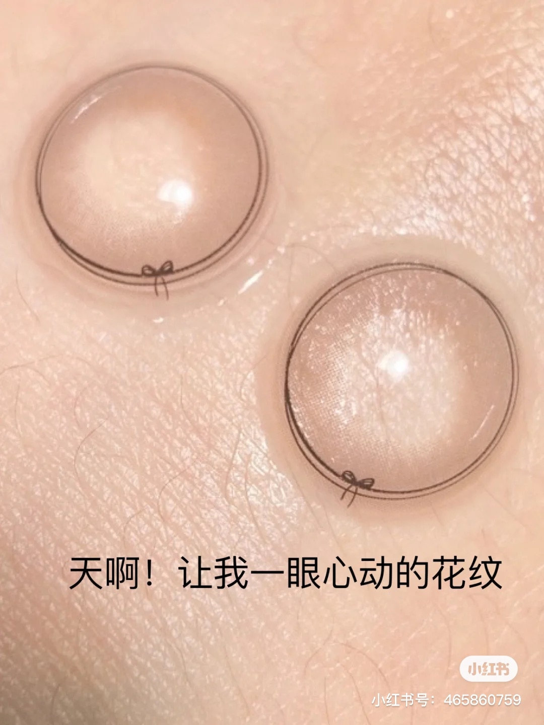 蝴蝶結隱眼