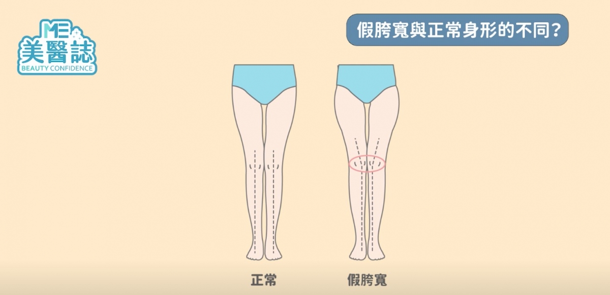 YouTube@Me Media 美醫誌