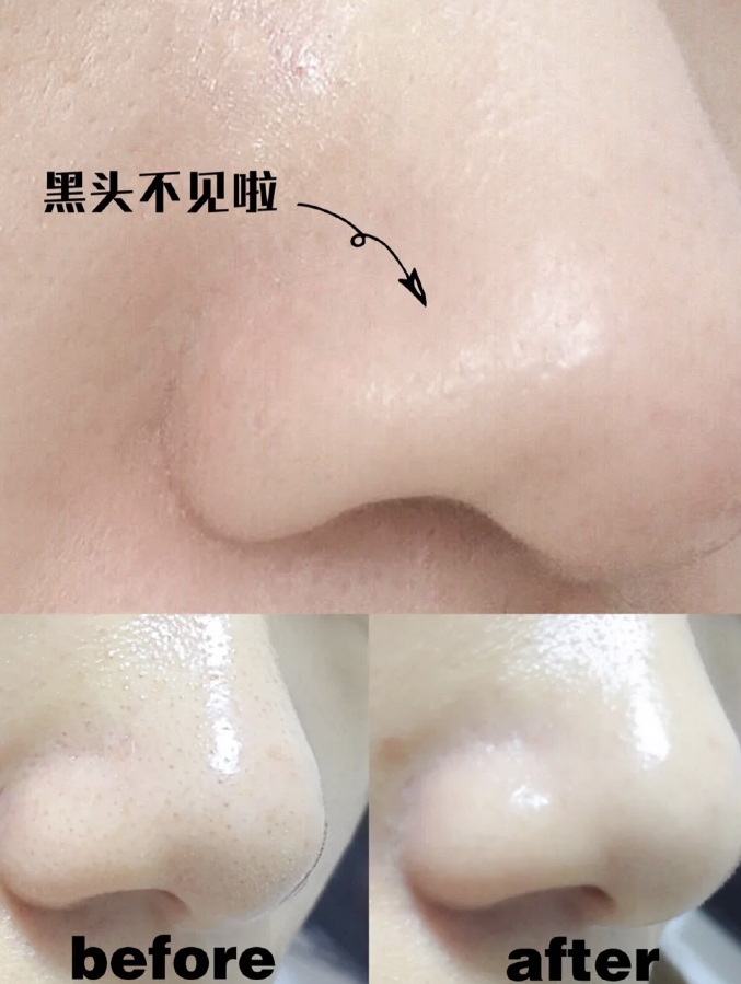 小紅書