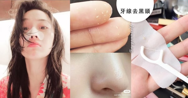 網路爆紅「牙線去黑頭粉刺」大法！草莓鼻秒變牛奶肌♡低成本清出粉刺林～