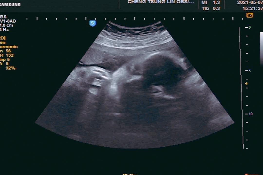 FB@小甜甜 張可昀