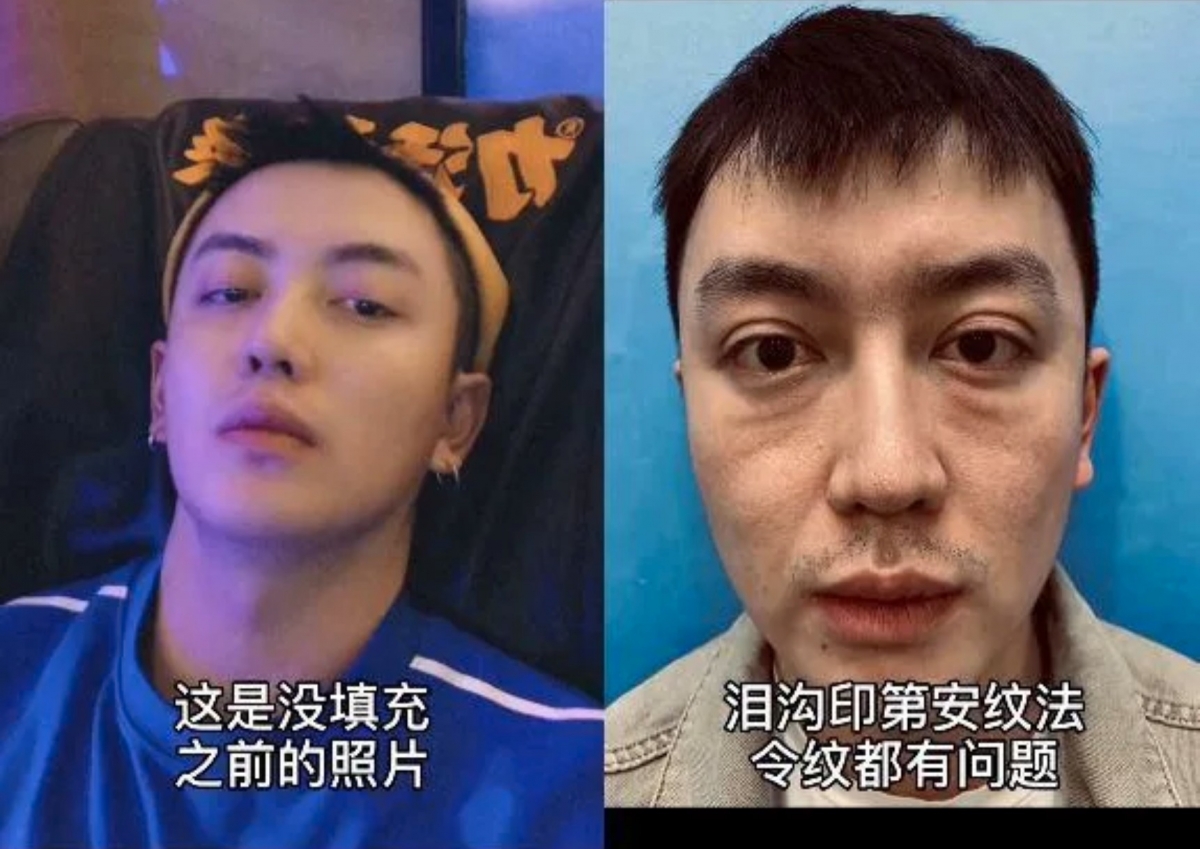 TikTok@金大威Abel