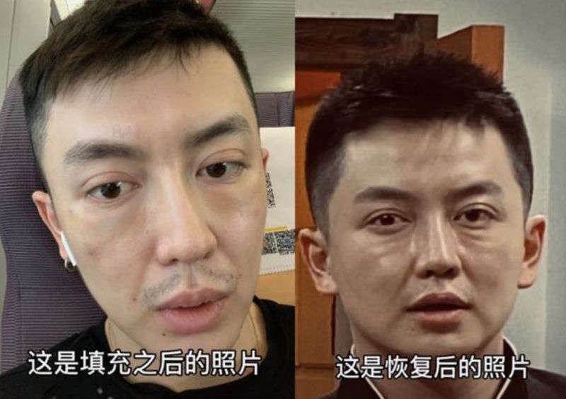 TikTok@金大威Abel