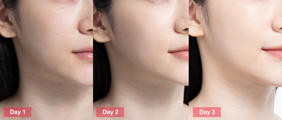 資生堂電波精華-4