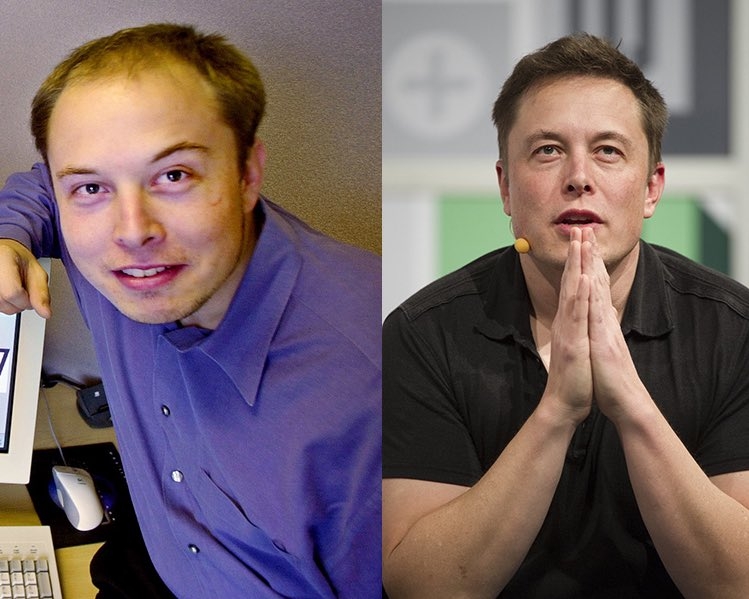 馬斯克「髮量變化」掀熱議