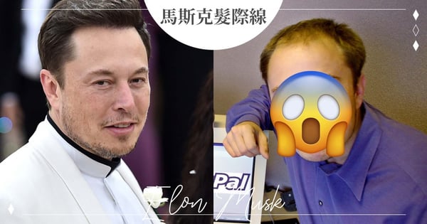 有錢就任性？馬斯克身價暴漲360億！網對比「年輕微禿→髮際線回春」笑了：賺錢動力