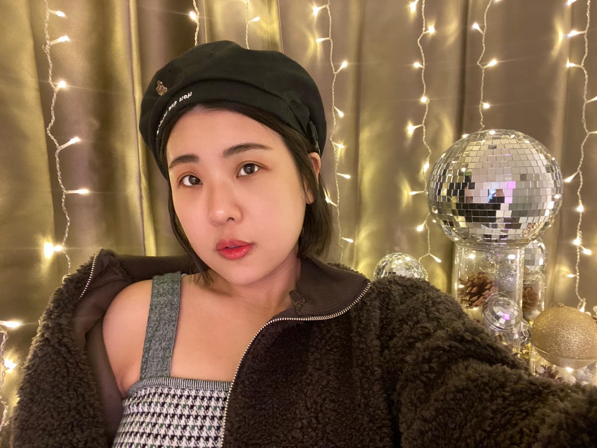 木星向媒體報平安，表示被煙蒂燙傷的傷口已經沒有大礙了。