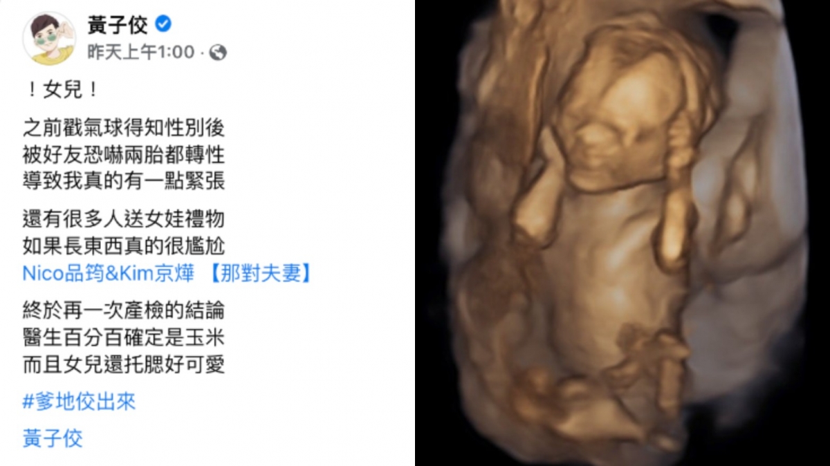 黃子佼本月14日PO文分享寶寶超音波照。