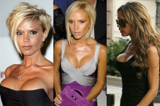 維多利亞坦承曾整容