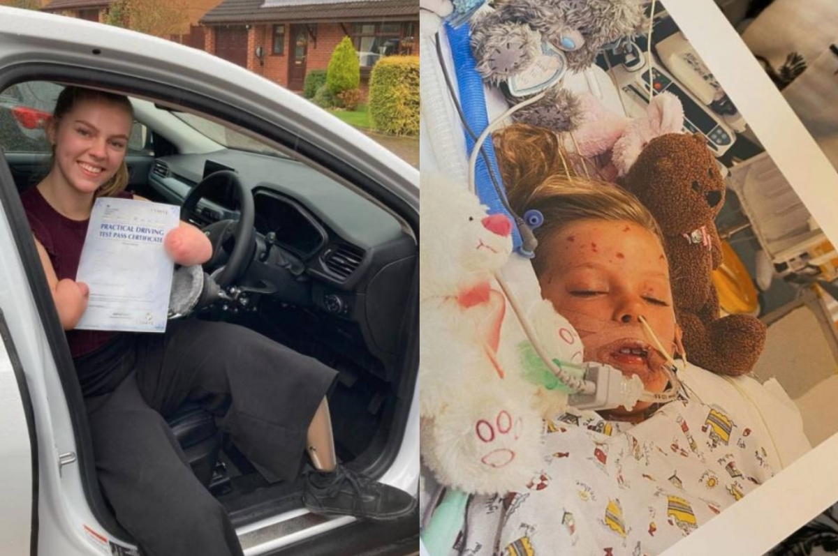 伊莎貝爾（Isabelle Weall）沒有因為失去四肢就自暴自棄，而是更加努力過生活。