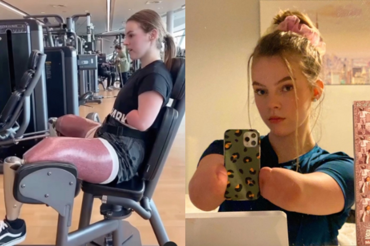 伊莎貝爾靠著多次練習，如今可以和四肢健全的人一樣去健身房運動與使用手機。