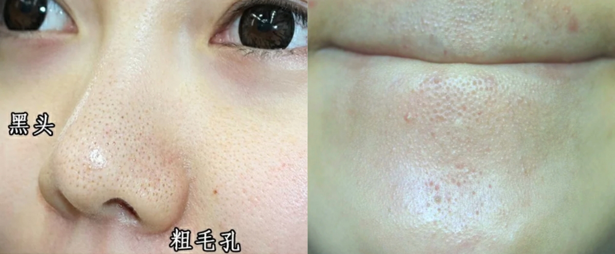 小紅書@APPLEPIE