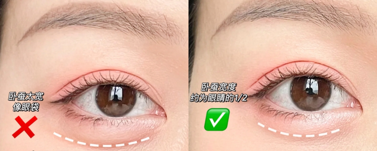 臥蠶誤區2:臥蠶太寬變眼袋超顯老