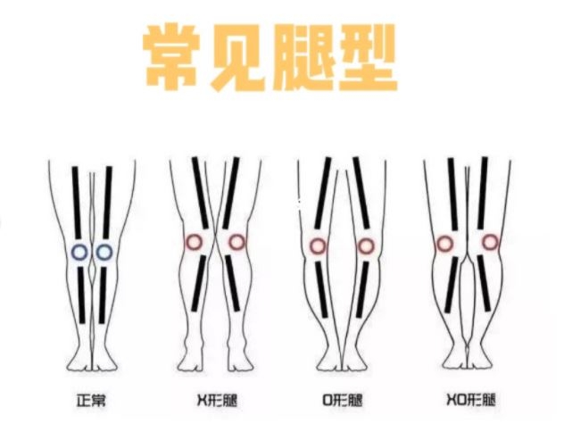 Check List!你是哪一種腿型