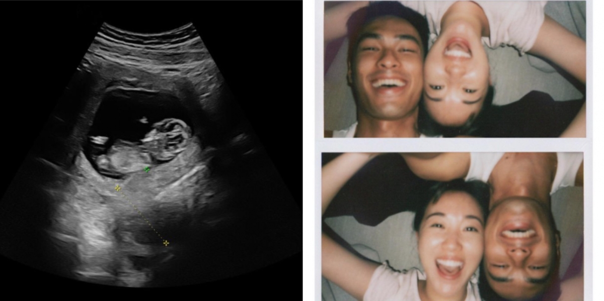 楊祐寧2020年5月認愛,並公開愛妻懷孕的好消息。