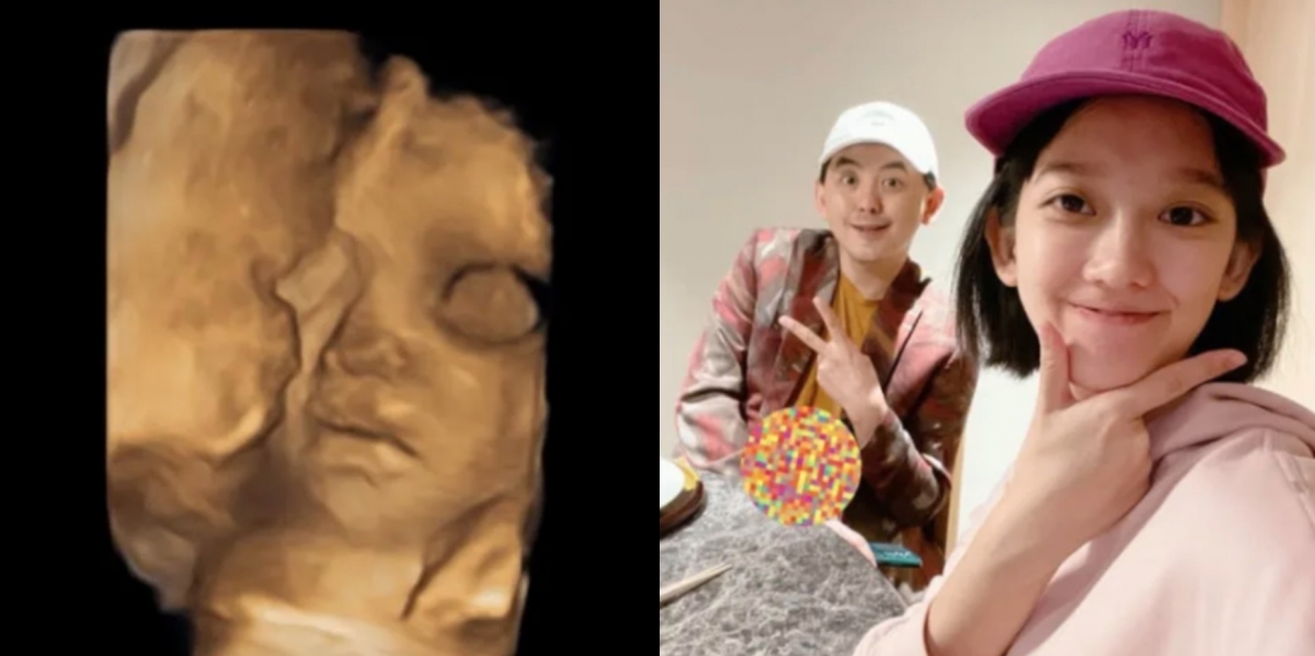 黃子佼與孟耿如將迎來女兒「黃玉米」。