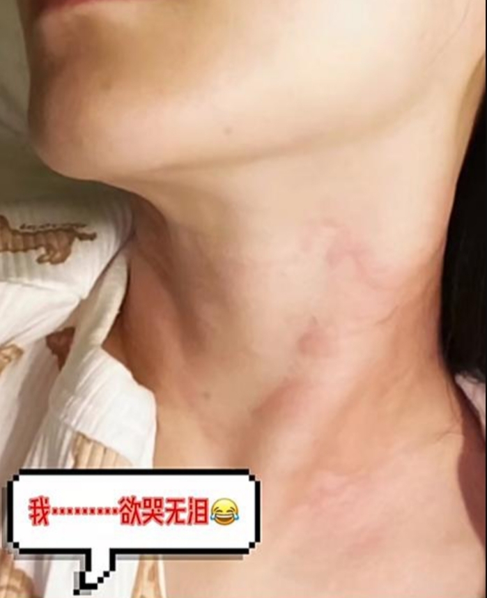 范冰冰曬出驚人膚況近照