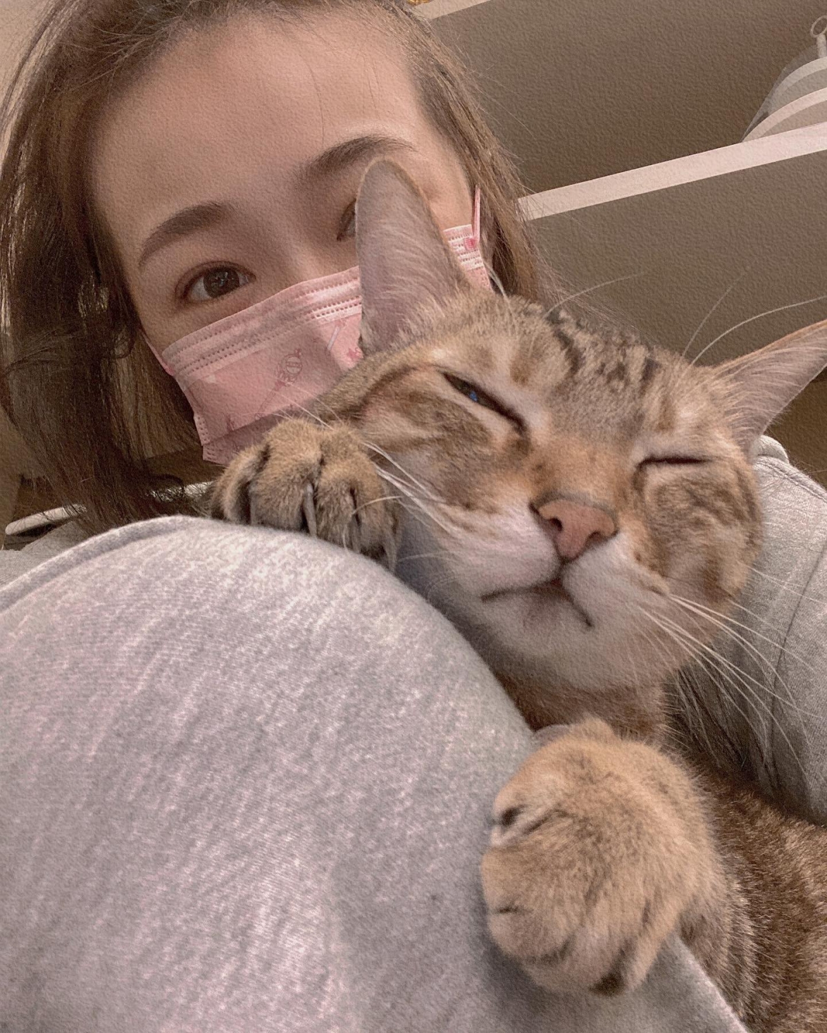 丫頭上《女人我最大》透露自己毀容