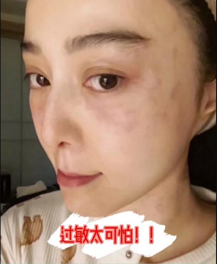 范冰冰曬出慘烈素顏照