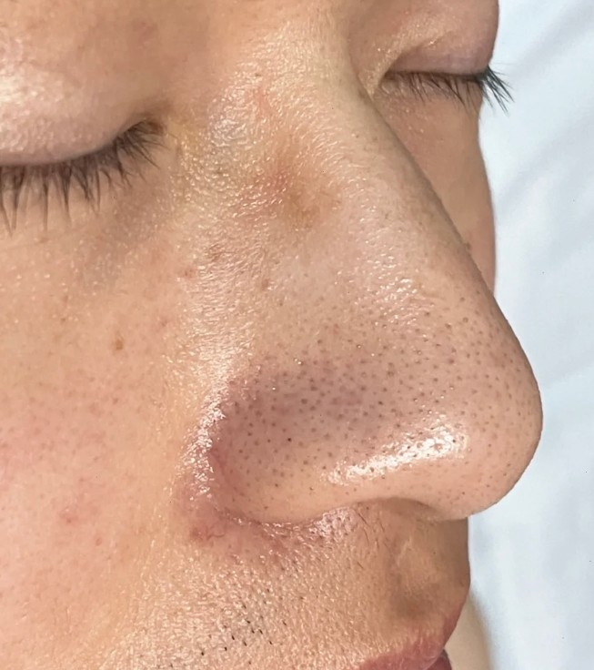 小紅書＠是瑶瑶ya