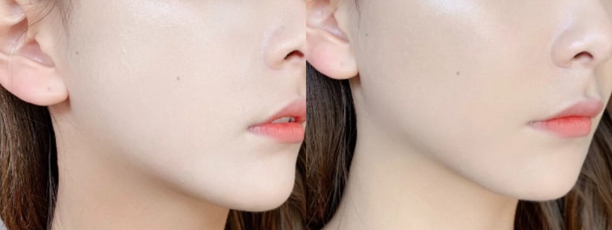 新手化妝顯老誤區1:底妝過白、面部凹陷明顯