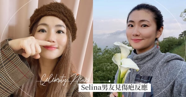 Selina男友見火吻傷疤反應曝光～溫柔喊出『這句話』讓Selina淚崩，感動曝：第一次聽到♡