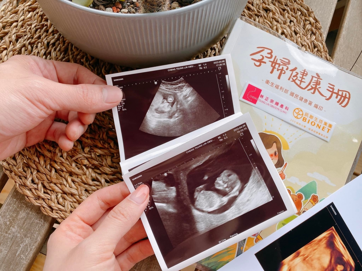 玉兔與老公曬寶寶超音波照