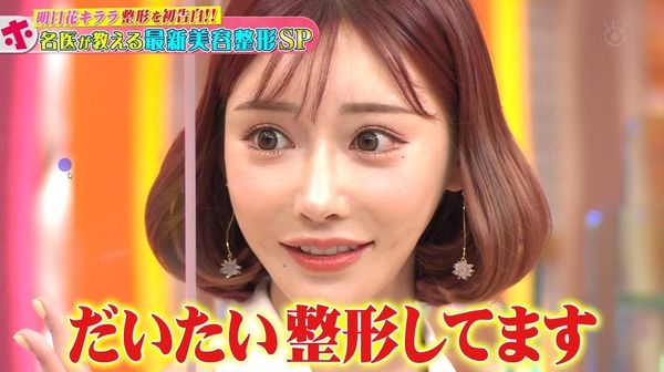 明日花綺羅認了全臉都有整形