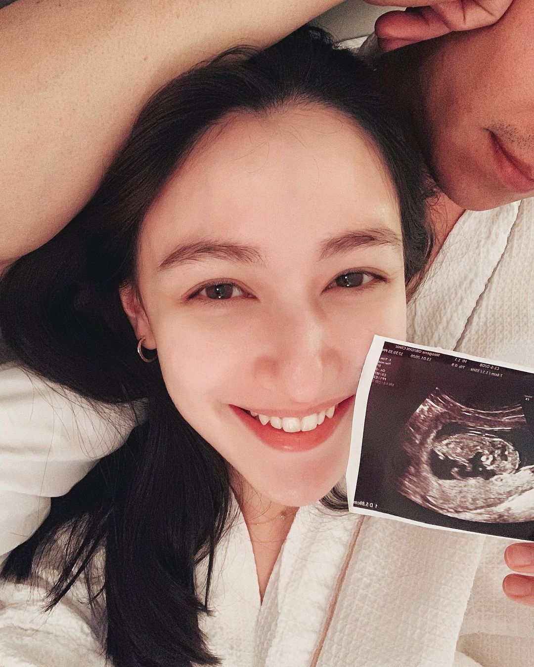 婚後連3年生下3子，成為三寶媽