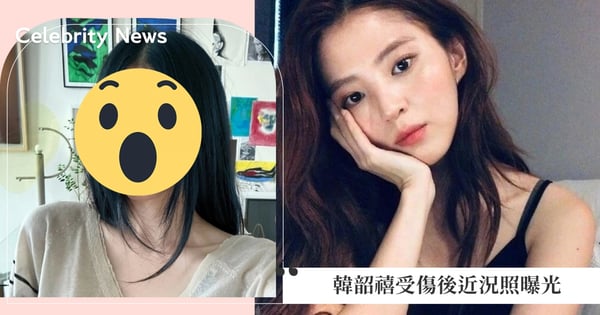 受傷後近況照曝光！韓韶禧驚喜現身粉絲聊天室報平安，曬自拍照暖心表示：大家對我來說是最大的安慰