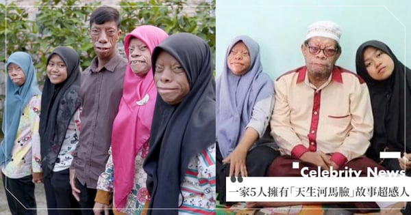 一家5人擁有「天生河馬臉」從小自卑、遭歧視！父找解藥尋千里落空，背後故事超感人～