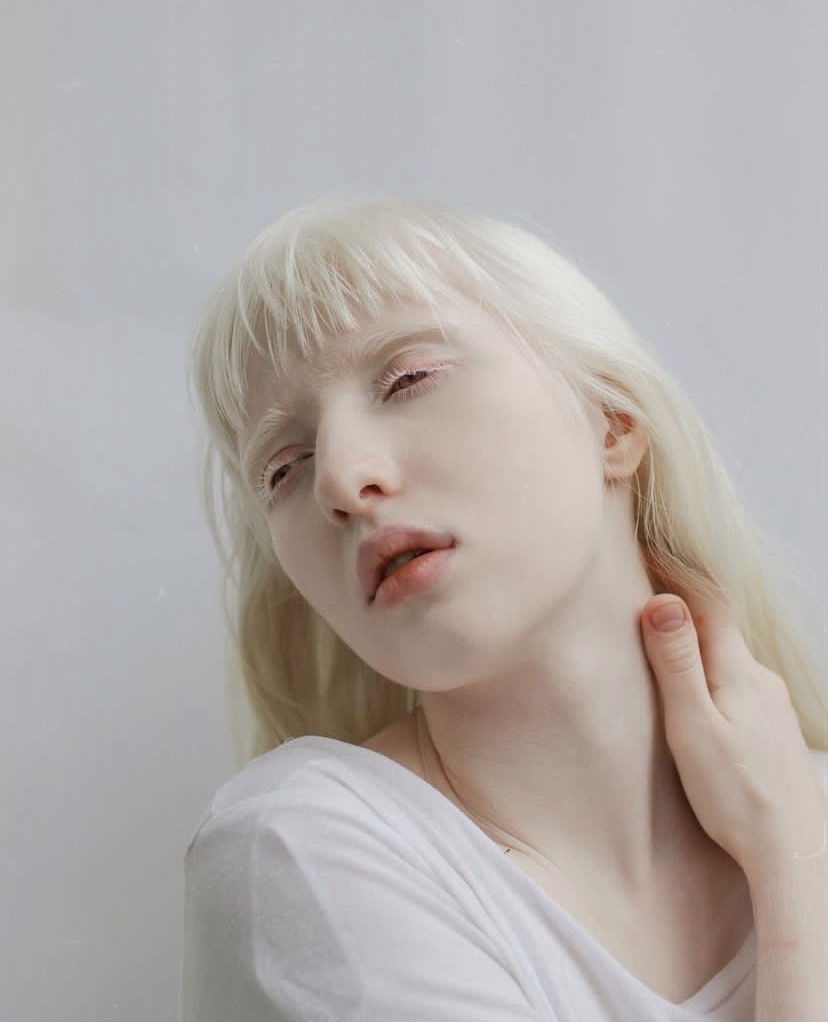 烏克蘭少女被譽為人間天使