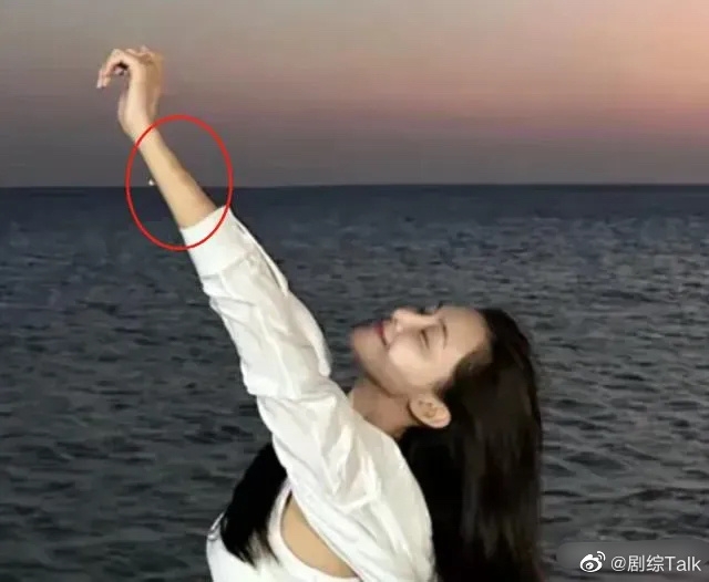 張穎穎瘀青照曝光