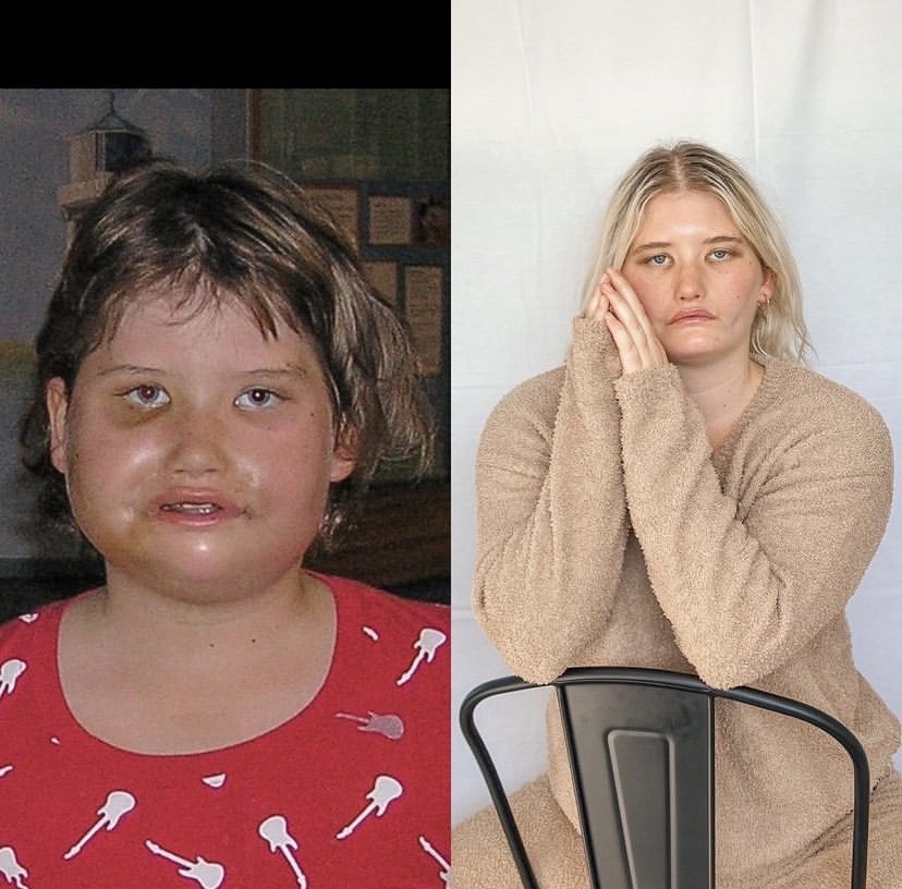 小時候臉上都是傷痕