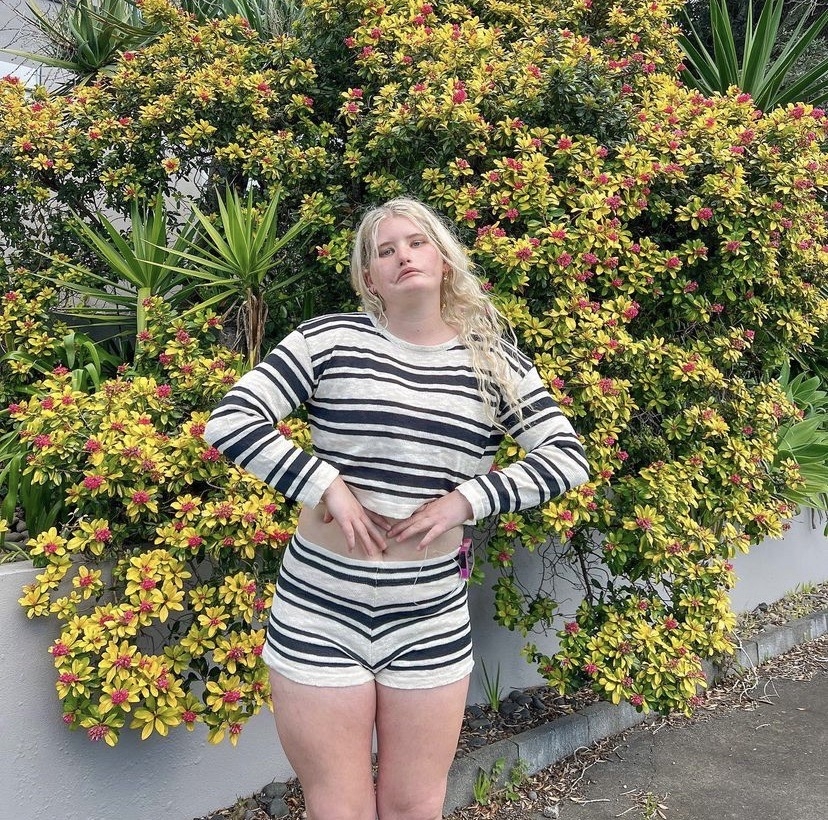 25歲的她逆襲成為模特兒