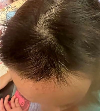 剃光女兒的頭髮