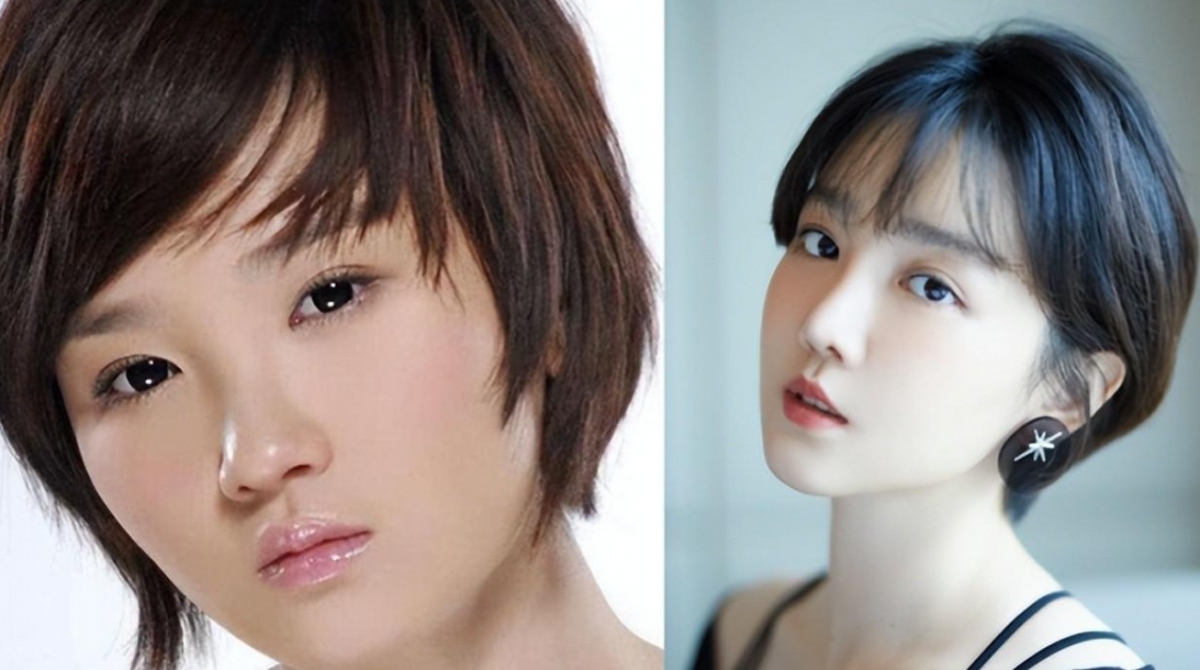 陳小紜整形前後。