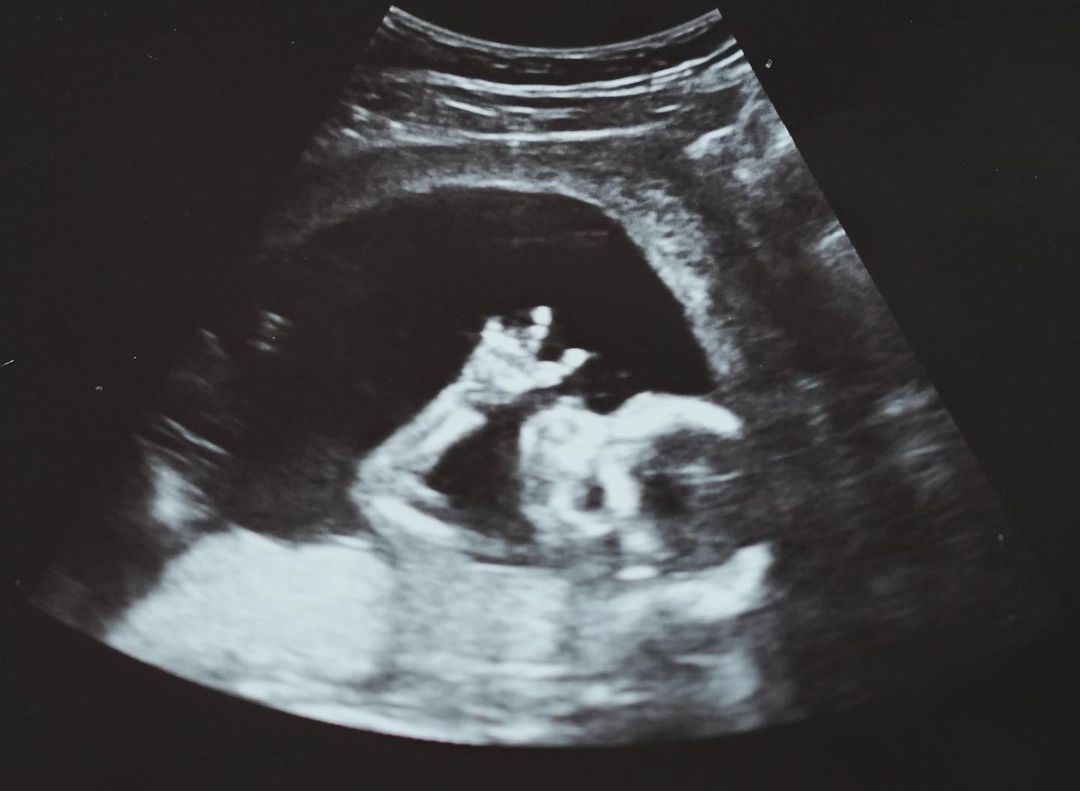 同月再曝老婆懷孕喜訊，即將成為人父